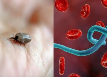 Αιμορραγικός πυρετός Κριμαίας-Κονγκό: Τι είναι, πώς μεταδίδεται και πόσο επικίνδυνος είναι