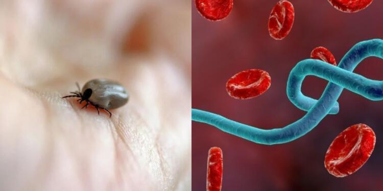 Αιμορραγικός πυρετός Κριμαίας-Κονγκό: Τι είναι, πώς μεταδίδεται και πόσο επικίνδυνος είναι