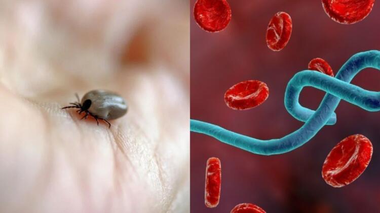 Αιμορραγικός πυρετός Κριμαίας-Κονγκό: Τι είναι, πώς μεταδίδεται και πόσο επικίνδυνος είναι