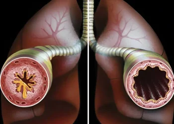 1 φλιτζάνι για να καθαρίσετε τους πνεύμονές σας από φλέγματα και τοξίνες