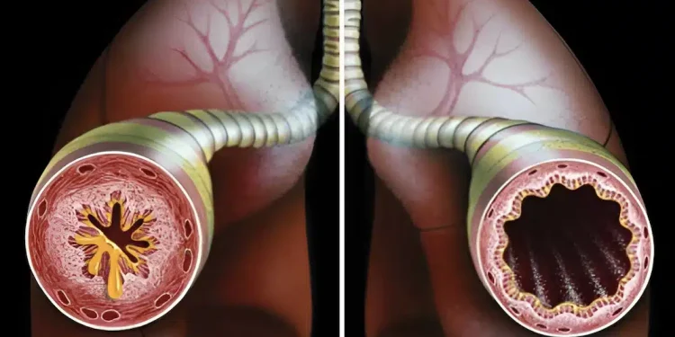 1 φλιτζάνι για να καθαρίσετε τους πνεύμονές σας από φλέγματα και τοξίνες