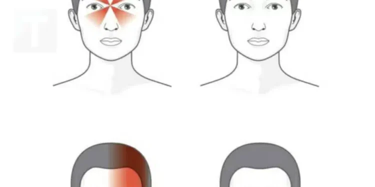 Έτσι αποκαλύπτουν οι πονοκέφαλοι τι δεν πάει καλά με την υγεία σας