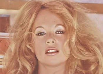 Απίστευτο: Έκανε τις ίδιες θεραπείες με την Αλίκη και «έφυγε» και αυτή στα 62