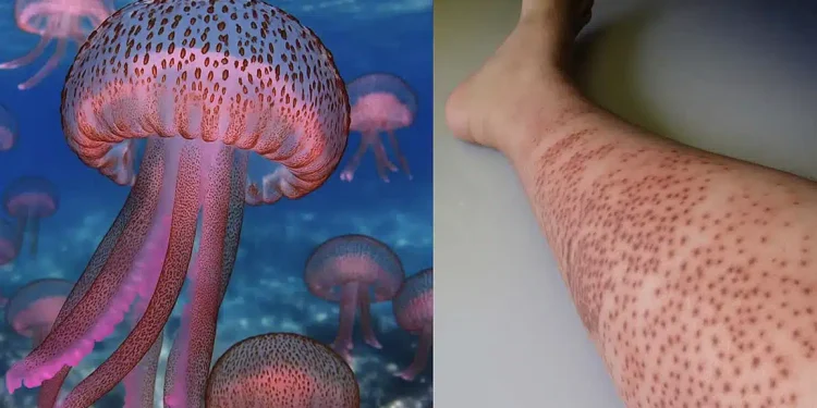 «Καμπανάκι» για μωβ μέδουσες σε θάλασσες στην Ελλάδα – Οι περιοχές που είναι στο «κόκκινο»