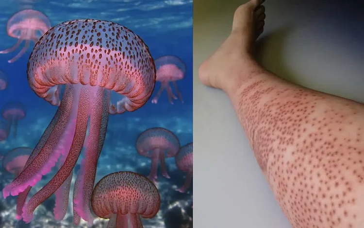 «Καμπανάκι» για μωβ μέδουσες σε θάλασσες στην Ελλάδα – Οι περιοχές που είναι στο «κόκκινο»