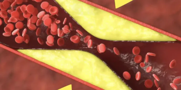 Τα καλύτερα φρούτα για να ξεβουλώσετε και να καθαρίσετε τα αιμοφόρα αγγεία σας