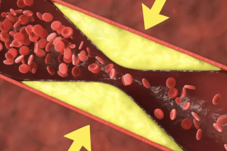 Τα καλύτερα φρούτα για να ξεβουλώσετε και να καθαρίσετε τα αιμοφόρα αγγεία σας