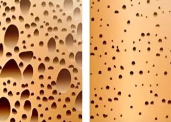 Αυτό το ποτό καταστρέφει τα οστά σας σύμφωνα με μελέτες