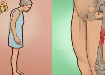 Οστεοπόρωση: Το ελληνικό βότανο που δυναμώνει και προστατεύει τα κόκκαλα