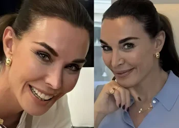 Καίει φωτογραφίες η Στεφανίδου: Δείτε το πραγματικό της πρόσωπο πριν τις πλαστικές