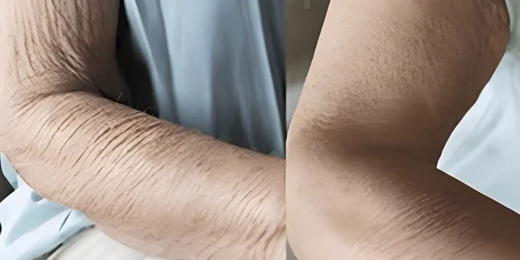 Πώς να φροντίσετε το δέρμα που γερνάει