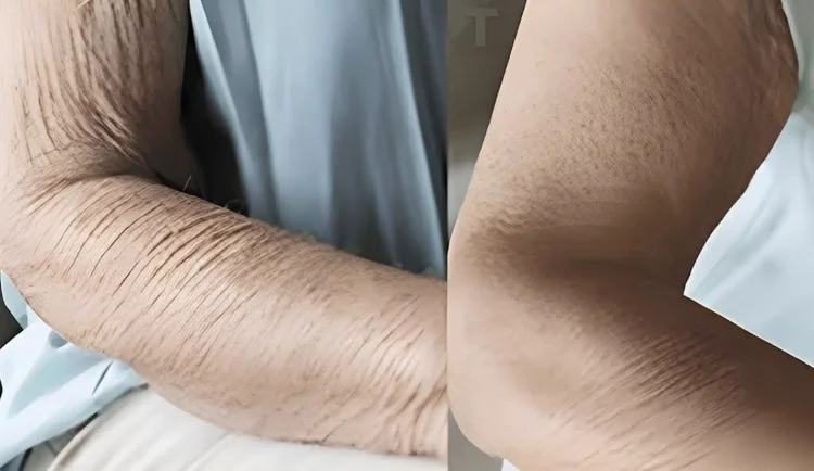 Πώς να φροντίσετε το δέρμα που γερνάει