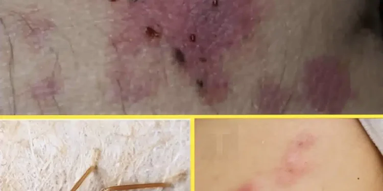 ΠΡΟΣΟΧΗ: Αν δείτε αυτά τα σημάδια στο δέρμα σας, σημαίνει…