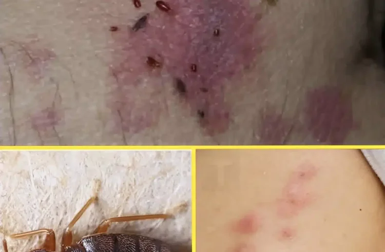 ΠΡΟΣΟΧΗ: Αν δείτε αυτά τα σημάδια στο δέρμα σας, σημαίνει…