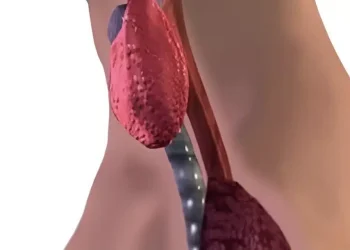 6 τύποι τροφών που επηρεάζουν αρνητικά τον θυρεοειδή σας