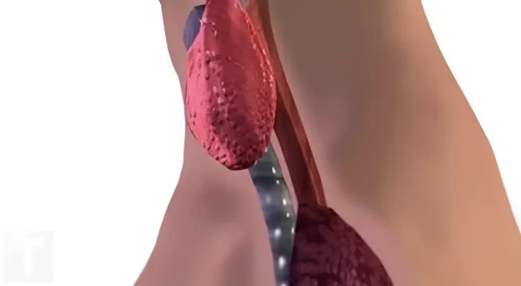 6 τύποι τροφών που επηρεάζουν αρνητικά τον θυρεοειδή σας