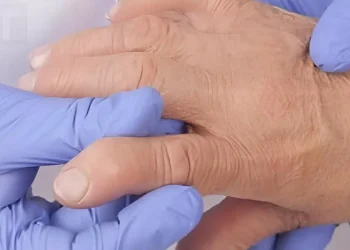 Τρόφιμα που πρέπει να αποφύγετε όταν έχετε ρευματοειδή αρθρίτιδα