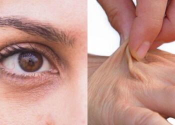 Πρόωρη γήρανση: 4 τροφές που στεγνώνουν το δέρμα, δημιουργούν φλεγμονή και σας κάνουν να φαίνεστε μεγαλύτεροι