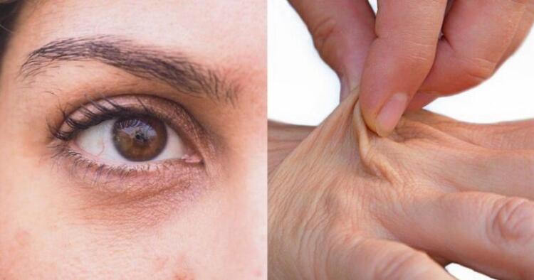 Πρόωρη γήρανση: 4 τροφές που στεγνώνουν το δέρμα, δημιουργούν φλεγμονή και σας κάνουν να φαίνεστε μεγαλύτεροι