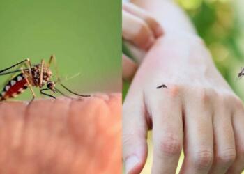 Μαθεύτηκε η βιταμίνη που σας λείπει και σας τσιμπάνε τα κουνούπια: Τι να τρώτε για να την αναπληρώσετε