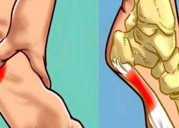 Άκανθα πτέρνας: Τι είναι – Γιατί εμφανίζεται – Πώς να την θεραπεύσετε με φυσικό τρόπο