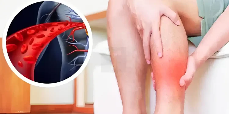 H βιταμίνη που ανοίγει τα αιμοφόρα αγγεία και βελτιώνει την κυκλοφορία