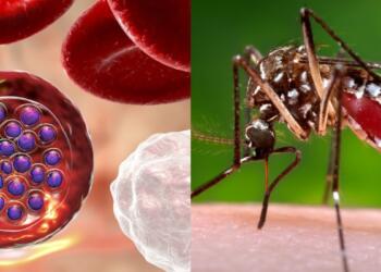 Ελονοσία: Η θανατηφόρα ασθένεια που μεταδίδεται από τα κουνούπια – Ποια είναι τα συμπτώματα της λοίμωξης