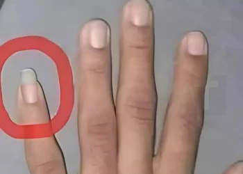 Γιατί μερικοί άντρες αφήνουν το νύχι του μικρού δαχτύλου μακρύ;
