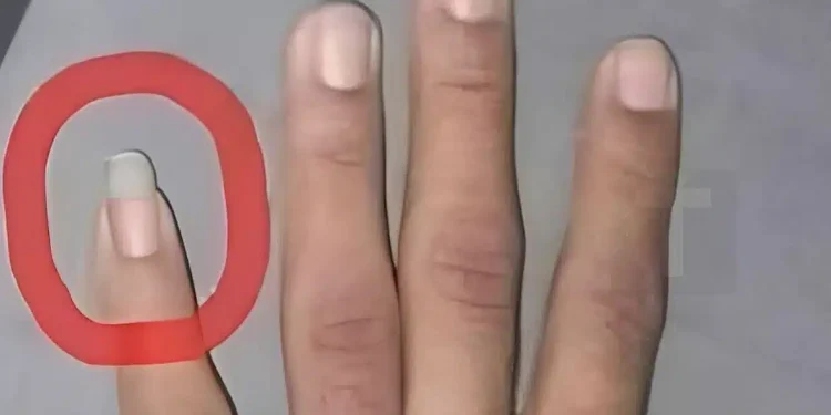 Γιατί μερικοί άντρες αφήνουν το νύχι του μικρού δαχτύλου μακρύ;