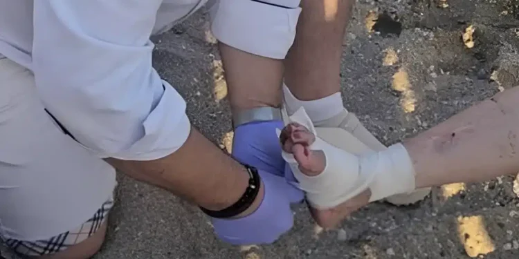 Tpόμος σε παραλία της Αττικής – Θαλάσσια χελώνα έκοψε δάχτυλο γυναίκας και επιτέθηκε σε άλλους δύο λουόμενους