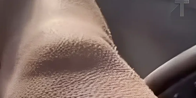 Όταν η ανατριχίλα μπορεί να είναι προειδοποιnτικό σημάδι