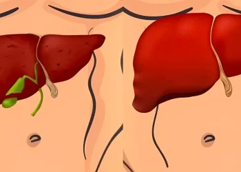 Φύλακες του ήπατος: 3 λαχανικά που «καθαρίζουν» και αποτοξινώνουν το ήπαρ