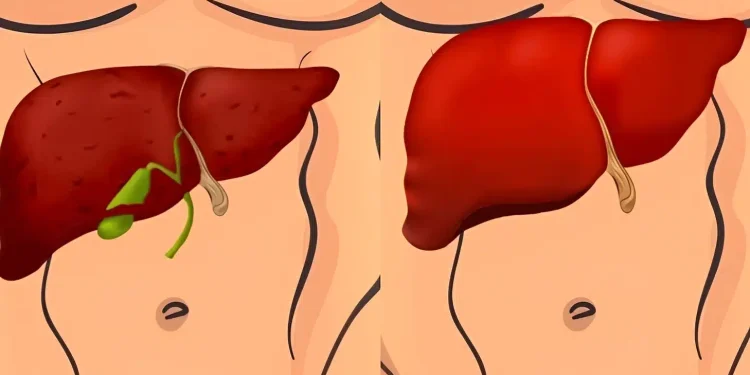 Φύλακες του ήπατος: 3 λαχανικά που «καθαρίζουν» και αποτοξινώνουν το ήπαρ