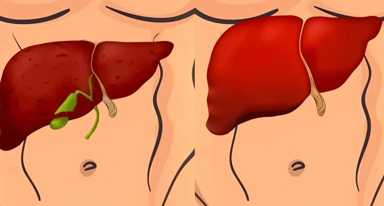 Φύλακες του ήπατος: 3 λαχανικά που «καθαρίζουν» και αποτοξινώνουν το ήπαρ