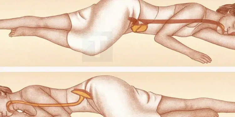 Τι κάνει ο ύπνος στην αριστερή πλευρά για τον εγκέφαλο, το στομάχι και την υγεία του λεμφικού συστήματος