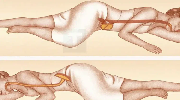 Τι κάνει ο ύπνος στην αριστερή πλευρά για τον εγκέφαλο, το στομάχι και την υγεία του λεμφικού συστήματος