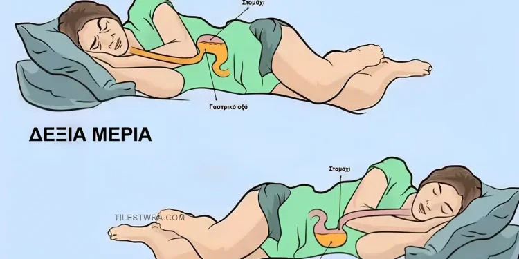 Για ποιο λόγο πρέπει να κοιμόμαστε από την αριστερή πλευρά;