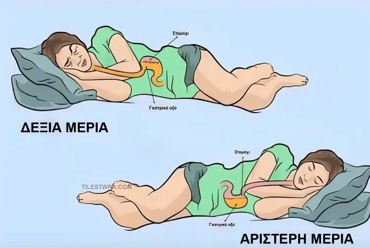 Για ποιο λόγο πρέπει να κοιμόμαστε από την αριστερή πλευρά;