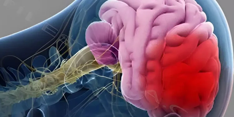 4 πράγματα που πολλοί κάνουν το πρωί και μπορεί να πάθουν εγκεφαλικό, όλες οι ηλικίες πρέπει να τα αποφεύγουν