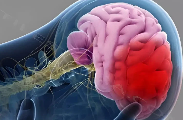 4 πράγματα που πολλοί κάνουν το πρωί και μπορεί να πάθουν εγκεφαλικό, όλες οι ηλικίες πρέπει να τα αποφεύγουν