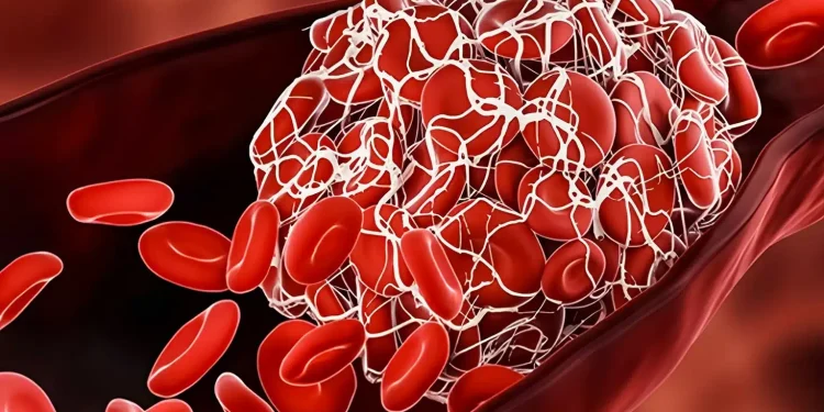 8 θρεπτικά συστατικά που χρειάζεστε για να διαλύσετε τους θρόμβους αίματος τώρα