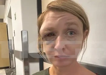 Κορωπί: «Έχουμε σχέση αγάπης με τον σύντροφό μου» λέει η 40χρονη που ξυλοκοπήθηκε – Συγκλονίζει η εικόνα της μετά την κακοποίηση