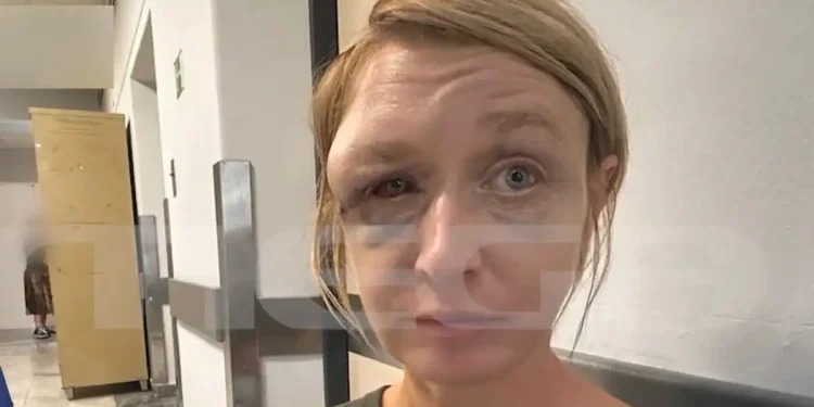 Κορωπί: «Έχουμε σχέση αγάπης με τον σύντροφό μου» λέει η 40χρονη που ξυλοκοπήθηκε – Συγκλονίζει η εικόνα της μετά την κακοποίηση