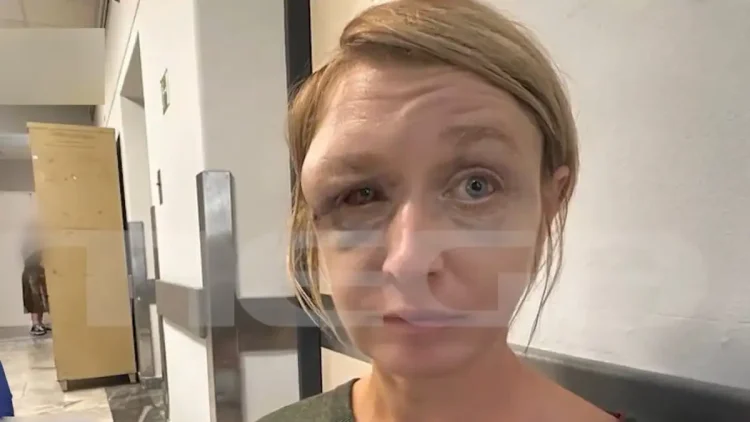 Κορωπί: «Έχουμε σχέση αγάπης με τον σύντροφό μου» λέει η 40χρονη που ξυλοκοπήθηκε – Συγκλονίζει η εικόνα της μετά την κακοποίηση