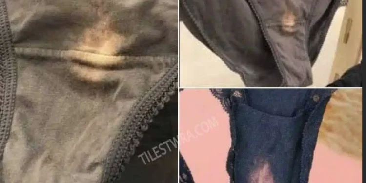 Τι σημαίνει αν δείτε ένα ξεθωριασμένο μέρος στο εσώρουχό σας