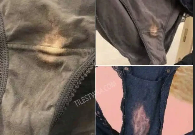 Τι σημαίνει αν δείτε ένα ξεθωριασμένο μέρος στο εσώρουχό σας