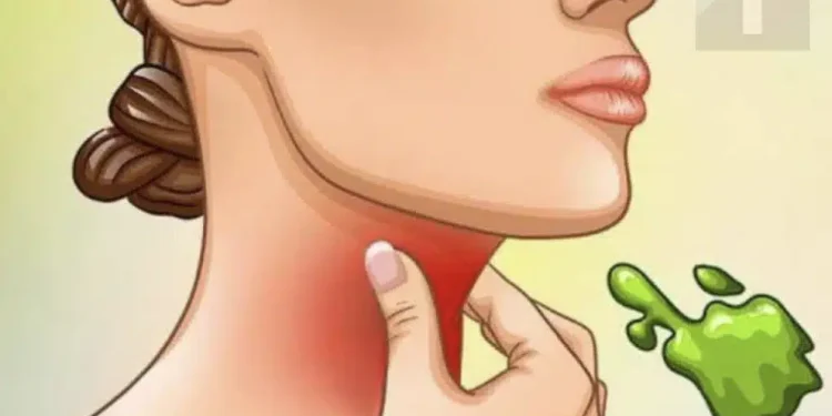 Οι πραγματικές αιτίες του συνεχούς φλέγματος στο λαιμό και πώς να απαλλαγείτε από αυτό