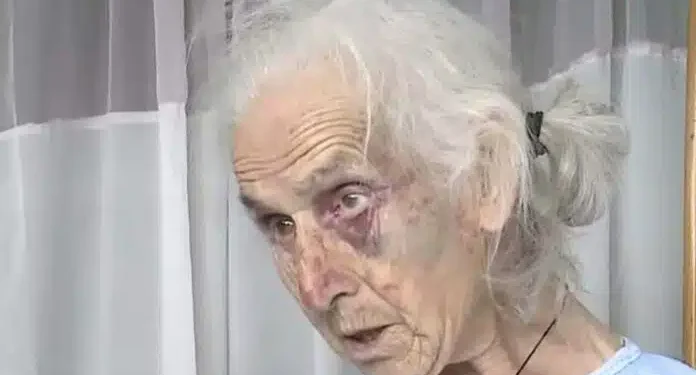 Εφιάλτης για 85χρονη: Την ξυλοκόπησαν άγρια στο σπίτι της για 100 ευρώ