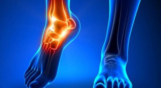 Ο χυμός που διαλύει το ουρικό οξύ στις αρθρώσεις