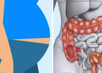 10 καθημερινά υγιεινά φαγητά που θα αποτοξινώσουν τον οργανισμό σας με φυσικό τρόπο